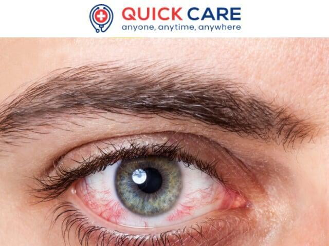 Treat Eye Allergies with best Opthamologists