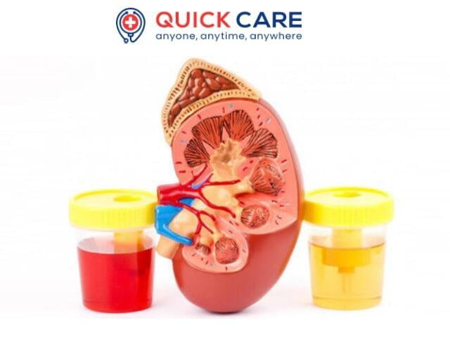 Get Complete info on Blood in Urine (Hematuria) Disease