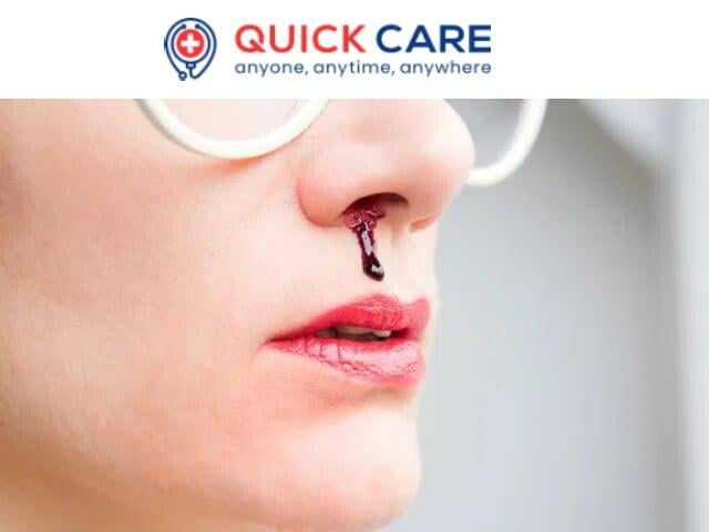 Nose Bleeding – Causes, Types & Medication