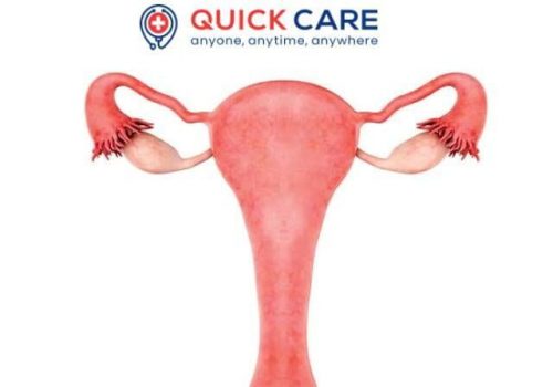 amenorrhea 2-img