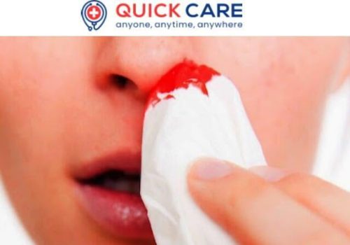 nose bleed 2 -1-img